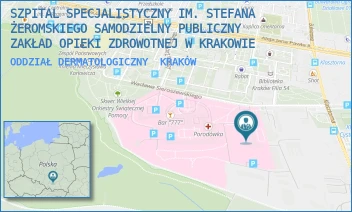 ODDZIAŁ DERMATOLOGICZNY - SZPITAL SPECJALISTYCZNY IM. STEFANA ŻEROMSKIEGO SAMODZIELNY PUBLICZNY ZAKŁAD OPIEKI ZDROWOTNEJ W KRAKOWIE - UL. OS. NA SKARPIE 67,  KRAKÓW