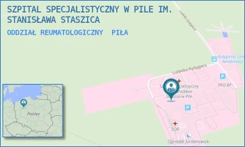 ODDZIAŁ REUMATOLOGICZNY - SZPITAL SPECJALISTYCZNY W PILE IM. STANISŁAWA STASZICA - RYDYGIERA 1,  PIŁA